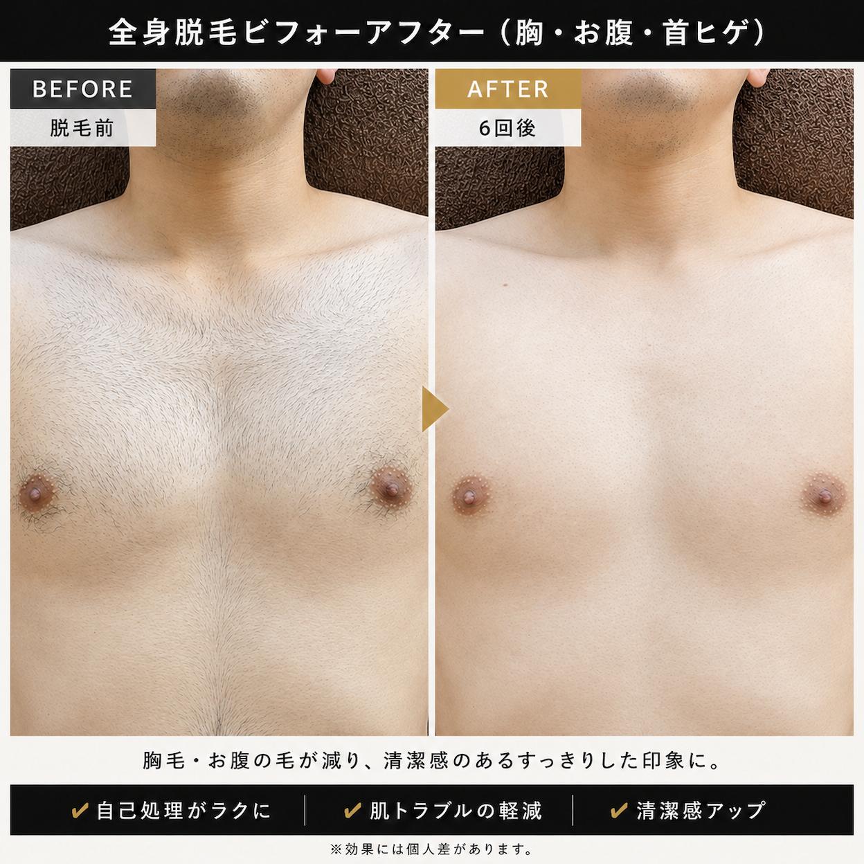 初回キャンペーン