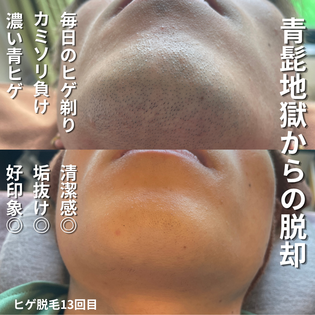 初回キャンペーン